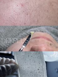 -Deeplus+韩国皮肤管理한국피부관리·C:Lab肌肤实验室