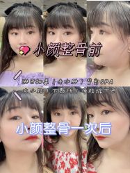 -小颜秘家·韩国整骨