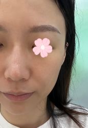体验后-深圳鹏爱悦心医疗美容医院