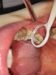 体验前-深圳春天阳光医院·轮廓抗衰中心