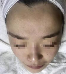 -友仟痘医生科学祛痘连锁
