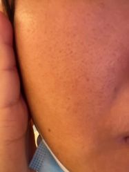 -深圳春天阳光医院·轮廓抗衰中心