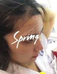 -大麦微针植发全国连锁