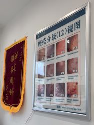 -瑶芳清颜草本祛痘