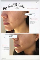 小v脸-光SPA科技美肤