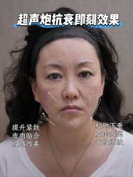 -Yestar重庆艺星医疗美容医院