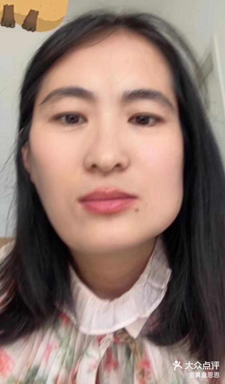 女孩子们其实很多困扰漂亮不漂亮是一回事如果面部都歪成这样了那可真