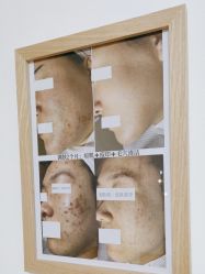 -美肤盾祛痘·问题肌头疗管理中心