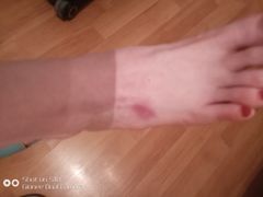 -深蓝盲人推拿·颈肩腰腿疼痛·艾灸调理(清河店)