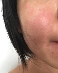 -上海玫瑰医疗美容医院