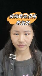 -素美医疗美容·西南眼鼻整形·修复基地