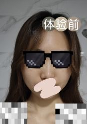 体验前-深圳美莱医疗美容医院