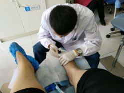 -派恩宜灰指甲·甲沟炎·鸡眼康护