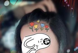 -大麦微针植发全国连锁