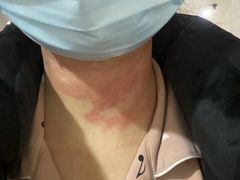 -无锡市第二人民医院(南院)