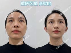 -Yestar重庆艺星医疗美容医院