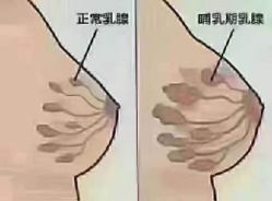 -骄阳兰多产后修复(徐东旗舰店)