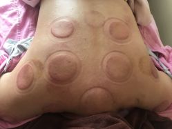 点击看大图 -伊童美家小儿推拿·中式养生(徐汇店)