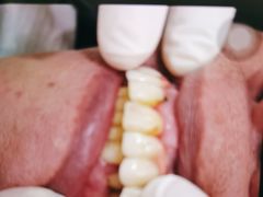-宁波壹加壹口腔·矫正种植中心