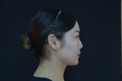-Yestar艺星整形美容医院
