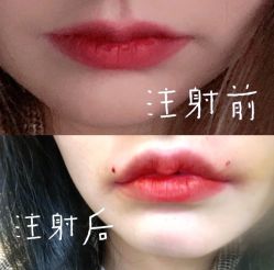 -恒妍医美·韩国定制抗衰中心