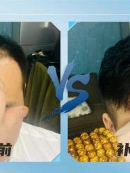 -极客侠男士假发定制补发