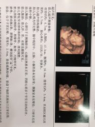 点击看大图 -潍坊艾玛妇产医院