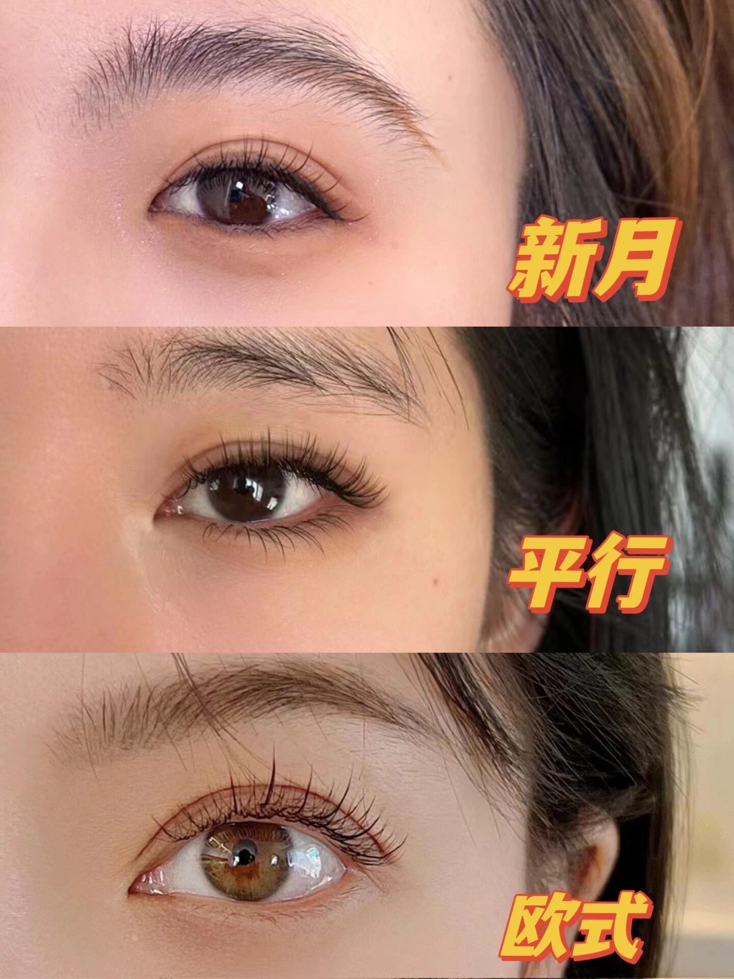 你的双眼皮是完美的