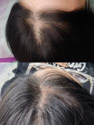 -西施无菌半永久纹绣眉眼影唇轻增发纹发际线