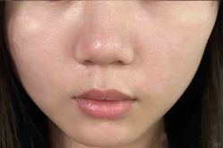 -上海伊莱美医疗美容医院