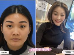 -天津健丽·去眼袋医疗美容机构