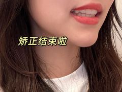 -极光口腔·矫正种植修复(锦江店)