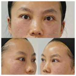 -天津健丽·去眼袋医疗美容机构