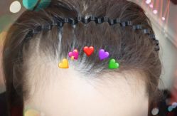 -大麦微针植发全国连锁