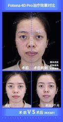 -丰联丽格医疗美容·联合丽格眼整形中心