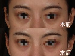 -杭州米兰柏羽医疗美容医院