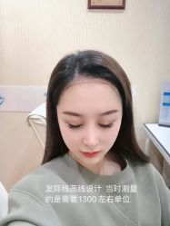 -碧莲盛·不剃发植发