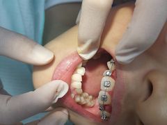 -牙博士口腔品牌连锁(杨浦店)