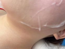 体验后-BR光电保养