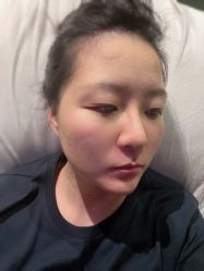 体验前-北京英煌医疗美容