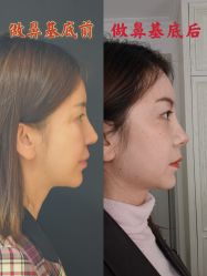 -北京米扬丽格医疗美容·联合丽格鼻整形中心