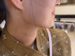 -四川米兰柏羽医学美容医院