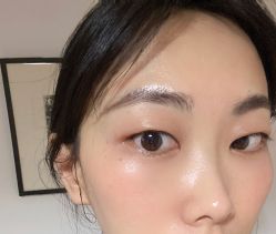 体验后-北京米扬丽格医疗美容·联合丽格鼻整形中心