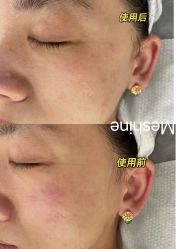 -美愈美肤MEIYU SKIN