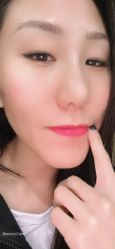 点击看大图 体验后-西安伊美尔医疗美容医院