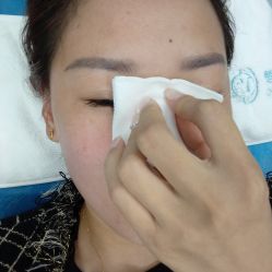 体验后-北京楚诺医疗美容