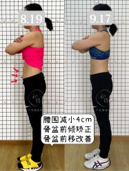 点击看大图 -初练产后康复