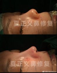 -北京米扬丽格医疗美容·联合丽格鼻整形中心