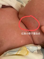 -爱陪伴一对一月子中心(融侨店)