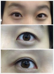 美瞳线-平萍纹绣韩式半永久定妆